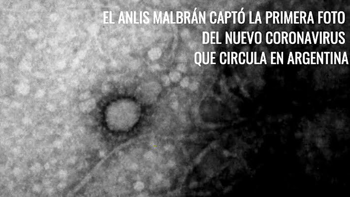 Coronavirus foto malbran 22abril2020