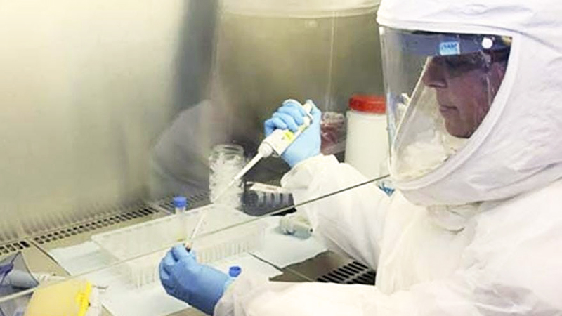 Coronavirus analisis bioquimica santarosa 28junio2021