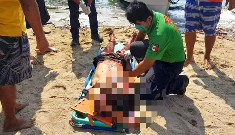 Argentinos atacados machetazos mexico herido 13mayo2023