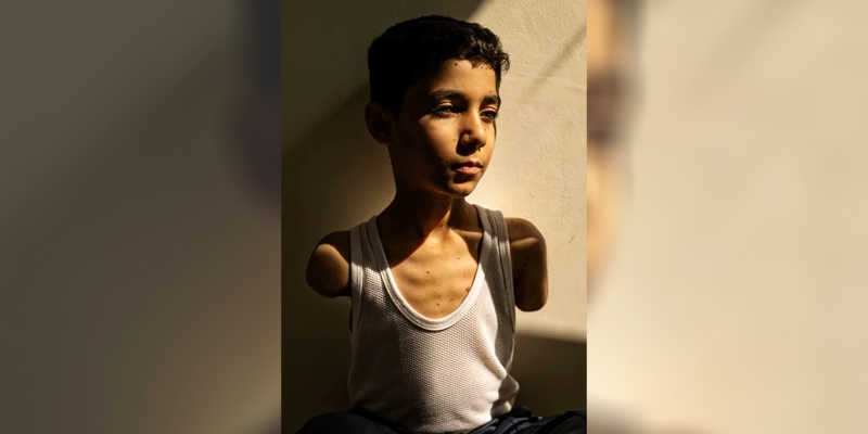 Palestino ninio mutilado foto premiada 18abril2025