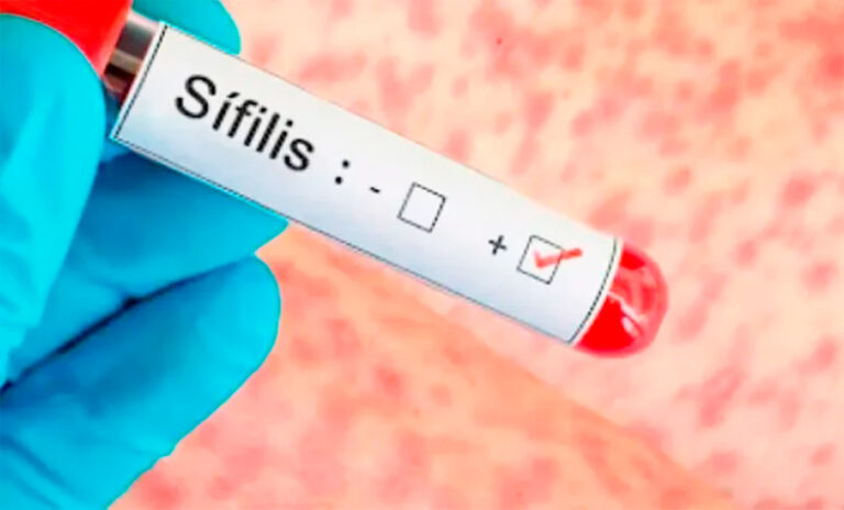 Sifilis analisis 21enero2026